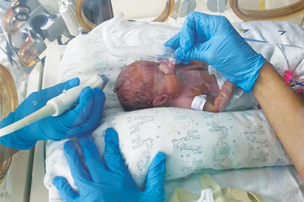 Update on baby Ulrich