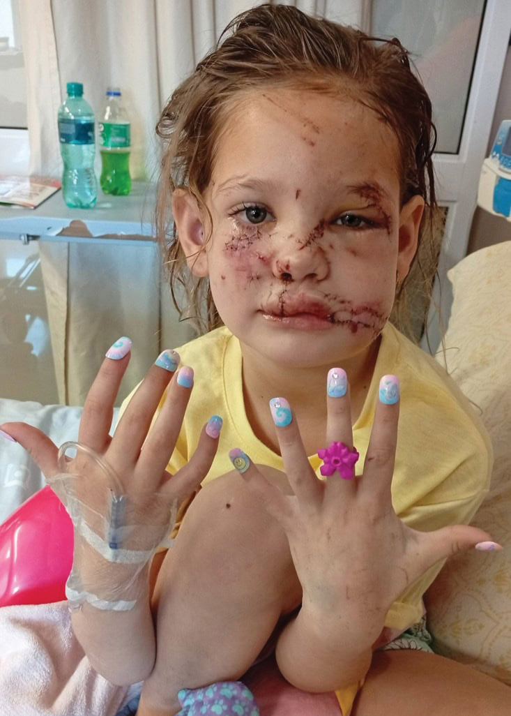 HOPE FOR AVANYA | Helping Avanya Smile Again